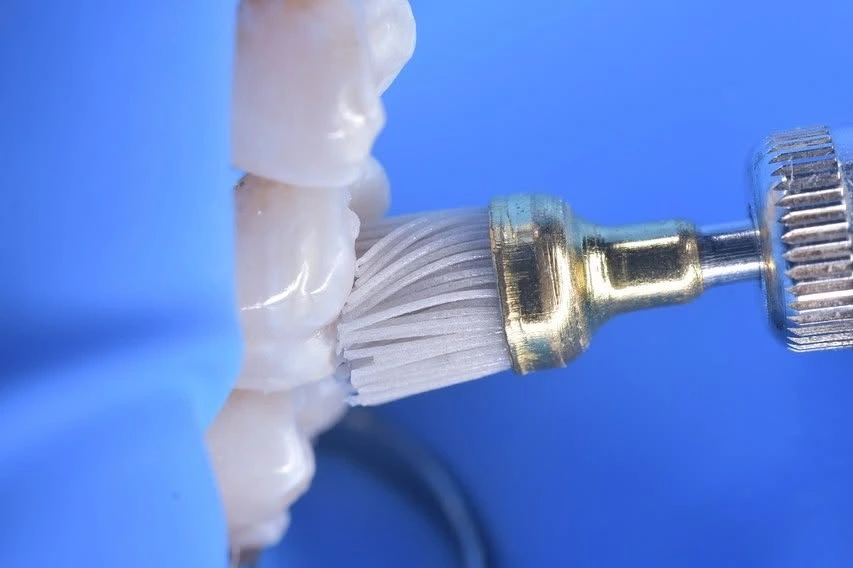 Cepillo de pulido sobre la superficie de los dientes
